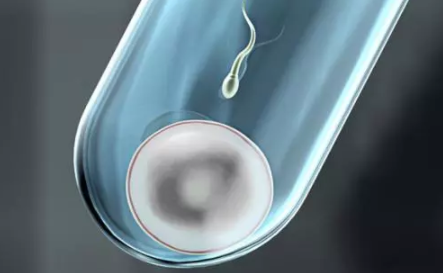 為什么很多人去泰國做試管嬰兒 泰國試管嬰兒有什么優勢