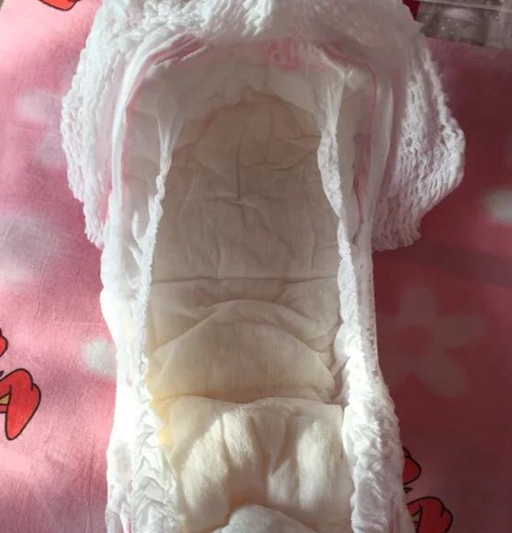 安兒樂成長褲拉拉褲會紅屁股嗎 安兒樂成長褲拉拉褲質量怎么樣