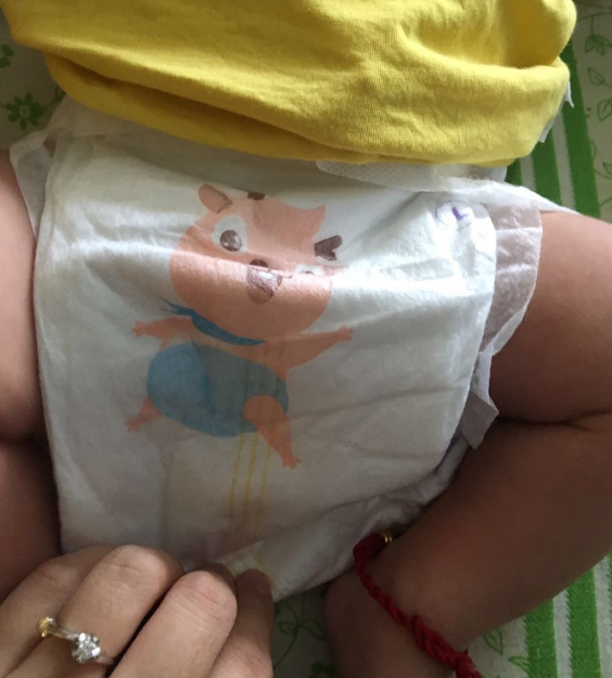 小鹿叮叮紙尿褲適合夏天嗎 小鹿叮叮紙尿褲會紅屁股嗎