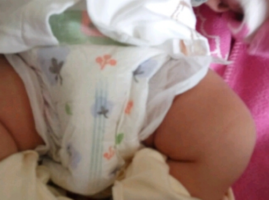 韓國寶松怡紙尿褲起坨嗎 韓國寶松怡紙尿褲好不好用