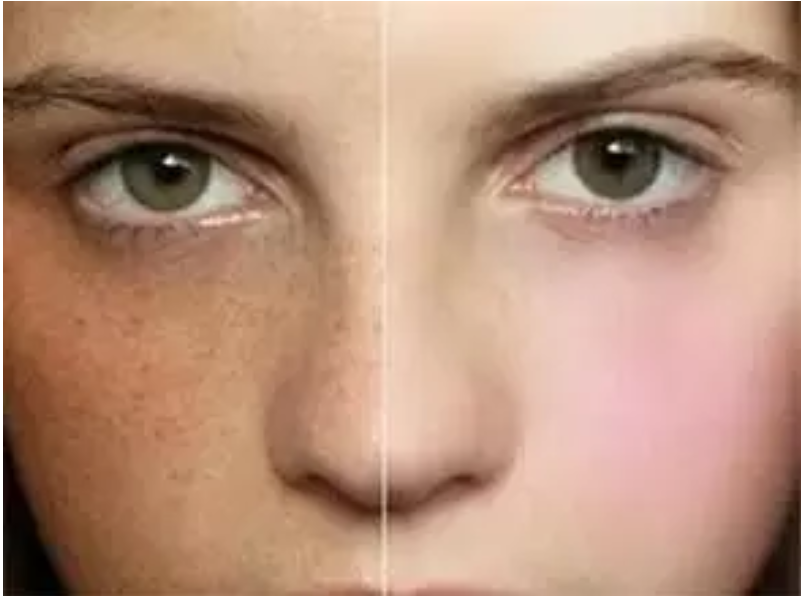 孕期長斑怎么辦 如何防止孕期長斑