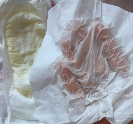 巴布豆紙尿褲適合夏天嗎 巴布豆紙尿褲夏天用悶屁股嗎