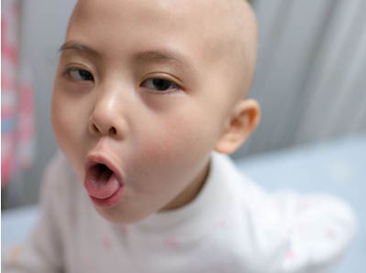 兒童白血病病率持續(xù)走高 白血病誘因是什么