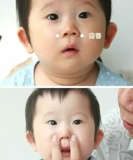 寶寶8個月流鼻涕怎么辦   治療流鼻涕最有效的方法