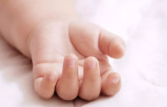 冬天寶寶手指長倒刺怎么辦 冬天寶寶手指長倒刺怎么護理