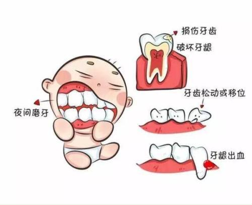 兩歲寶寶晚上睡覺磨牙 寶寶睡覺為什么愛磨牙