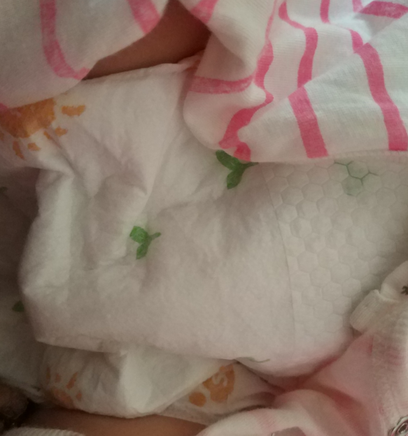 愛得利紙尿褲會紅屁股嗎 愛得利紙尿褲好不好用