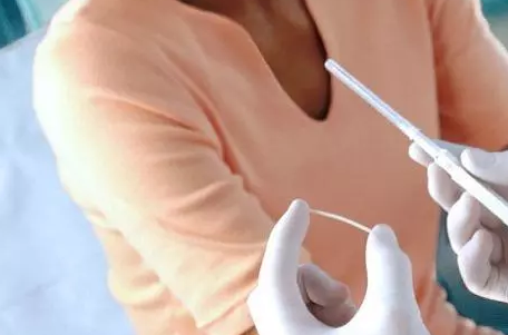 埋線避孕安全性高嗎 埋線避孕效果好不好