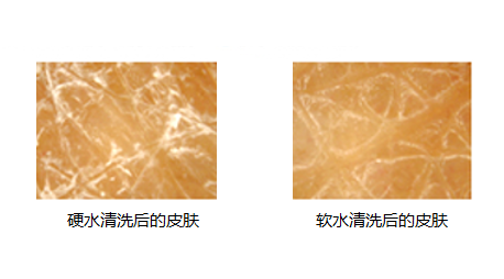 皮膚干燥用什么嬰兒潤膚霜好   寶寶潤膚霜選擇推薦