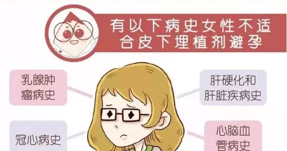 皮下埋線避孕多久取出來 皮下埋線避孕取出來過程