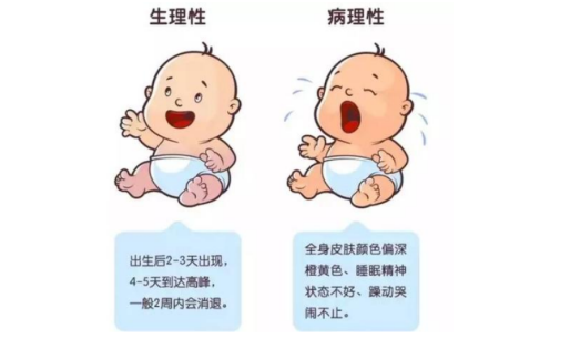 早產兒黃疸怎么辦  早產兒黃疸癥狀有哪些