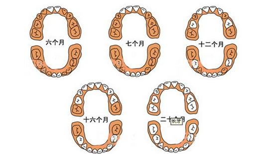 寶寶長牙發燒怎么辦   長牙發燒護理辦法