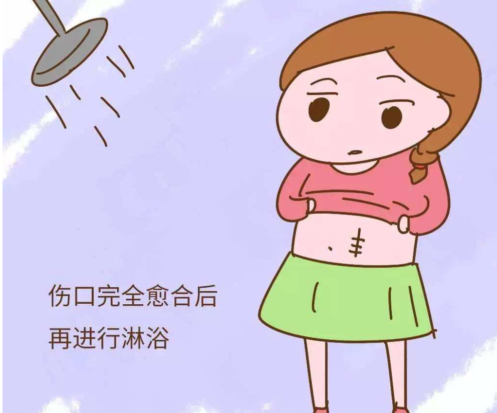 剖腹產(chǎn)后多久可以淋浴 剖腹產(chǎn)淋浴注意事項(xiàng)