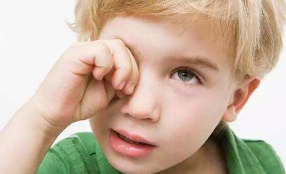 寶寶淚囊炎怎么預防  新生兒預防淚囊炎方法