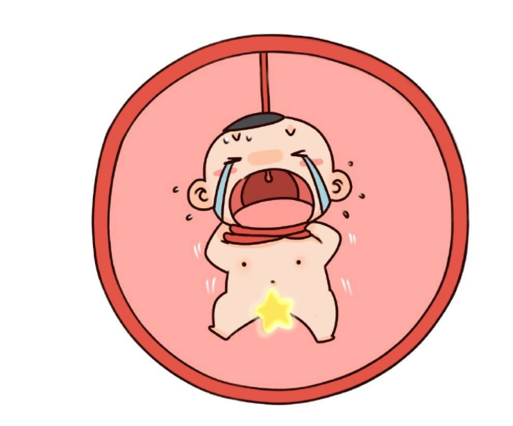 臍帶繞頸能順產(chǎn)嗎 臍帶繞頸兩周可以脫開嗎