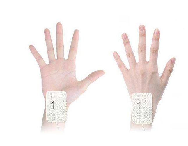 孕期腕管綜合征可以自愈嗎 如何預防孕期腕管綜合征