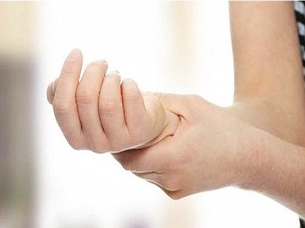 孕期腕管綜合征可以自愈嗎 如何預防孕期腕管綜合征