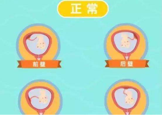 子宮前壁肌瘤影響懷孕嗎 患了子宮肌瘤怎么辦