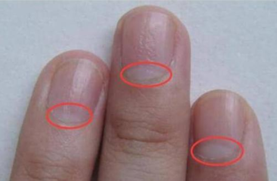 男性氣血不足有什么表現(xiàn) 氣血不足吃什么食物比較好