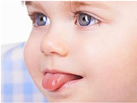 寶寶舌系帶過短是怎么回事 寶寶舌頭短說話不清楚嗎