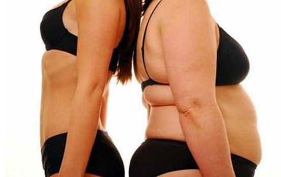 肥胖紋怎么消除 出現(xiàn)肥胖紋是怎么回事