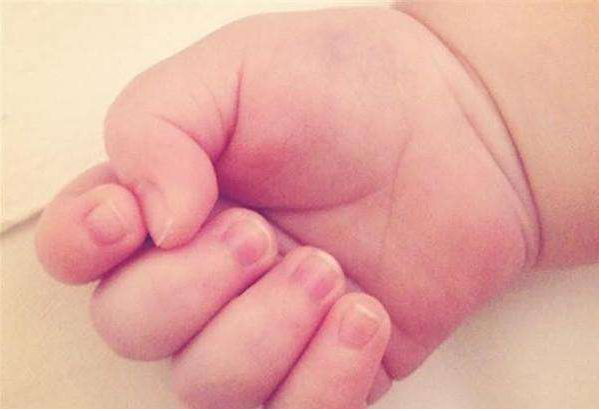 嬰幼兒指甲不長(zhǎng)是什么原因 如何糾正寶寶咬指甲的壞習(xí)慣
