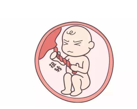 寶寶臍帶扭轉和睡姿有關嗎 寶寶臍帶扭轉是怎么回事