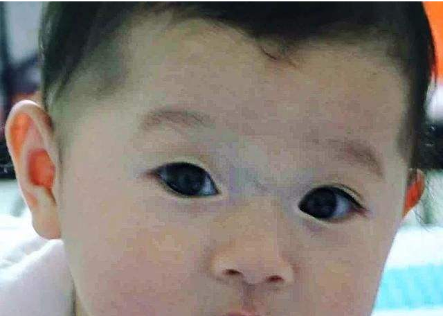 寶寶鼻梁上有青筋是不好帶嗎 寶寶鼻梁上有青筋怎么辦 寶寶鼻梁上有青筋是不好帶嗎 寶寶鼻梁上有青筋怎么辦