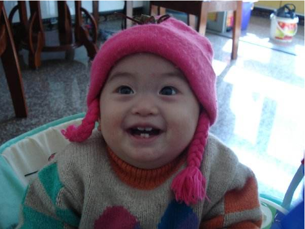 寶寶乳牙縫隙大正常嗎 寶寶門牙縫隙大怎么辦