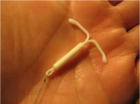 曼月樂環會使人衰老嗎 什么時候放曼月樂環好