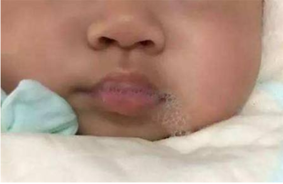 寶寶愛(ài)吐泡泡就是肺炎的表現(xiàn)嗎 寶寶總是吐泡泡怎么辦 寶寶愛(ài)吐泡泡就是肺炎的表現(xiàn)嗎 寶寶總是吐泡泡怎么辦