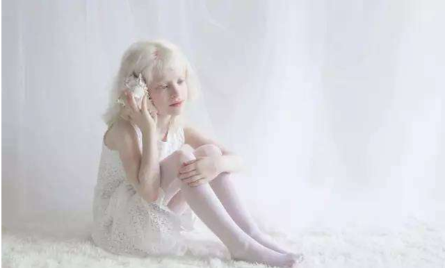 小孩白化病是怎么引起的 小孩白化病可以治愈嗎 小孩白化病是怎么引起的 小孩白化病可以治愈嗎