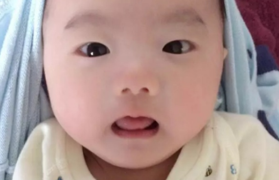 新生兒眼皮上紅斑會消失嗎   新生兒紅斑有哪些