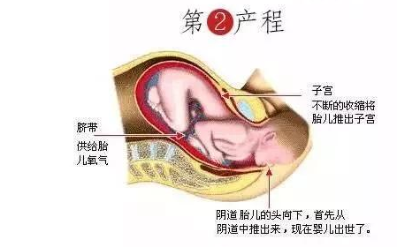 生孩子時該怎樣用力 生孩子不會使勁怎么辦