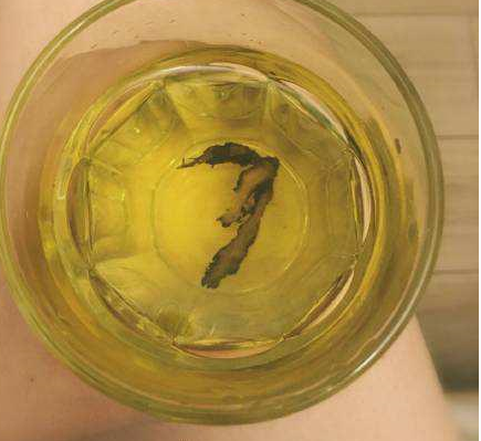 嬰兒胎毒怎么治 有什么要注意的嗎