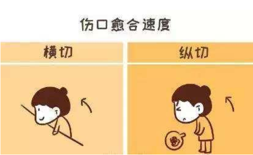 剖腹產(chǎn)橫切還是豎切好 剖腹產(chǎn)橫切豎切優(yōu)缺點(diǎn) 剖腹產(chǎn)橫切還是豎切好 剖腹產(chǎn)橫切豎切優(yōu)缺點(diǎn)