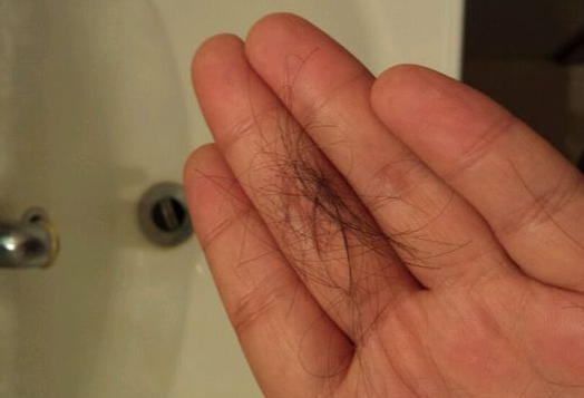 產后脫發吃什么好   產后脫發食物調理方法