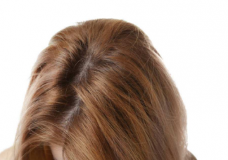 產后脫發的正確調理方法    產后脫發怎么改善