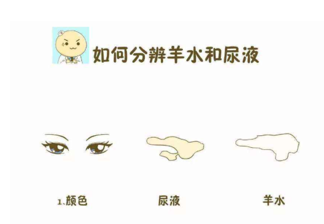 如何區分漏尿和羊水早破 孕婦提前破水的應對方法