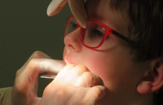 孩子牙齒斷了怎么辦  牙齒外傷注意事項