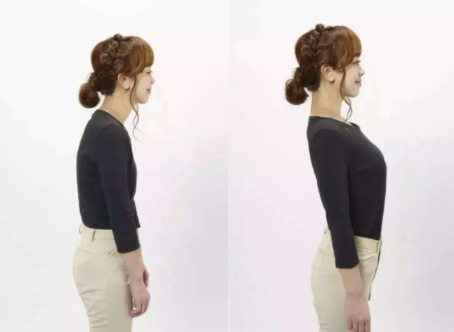 孩子含胸駝背怎么辦 孩子駝背怎么糾正 孩子含胸駝背怎么辦 孩子駝背怎么糾正