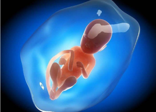 羊水過多是胎兒畸形嗎 羊水過多有什么危害