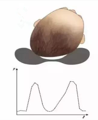 寶寶睡覺偏頭怎么糾正 寶寶偏頭睡有什么影響