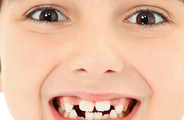 寶寶從什么時(shí)候開(kāi)始換牙 換牙期間要注意什么