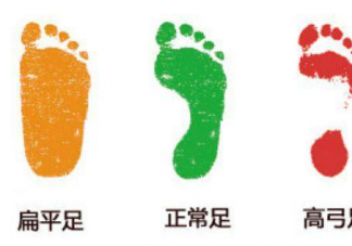為何新生兒都是扁平足呢 扁平足如何矯正