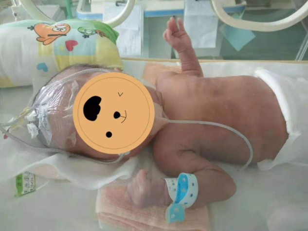 新生兒呼吸急促是什么原因 新生兒呼吸急促判斷方法