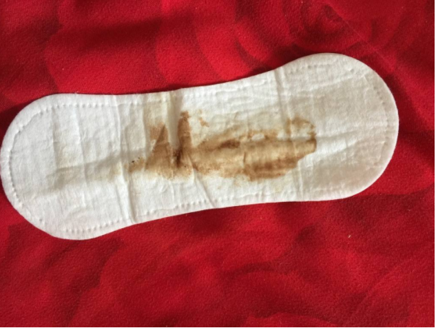 先兆流產就是流產嗎 孕期出現先兆流產癥狀怎么保胎