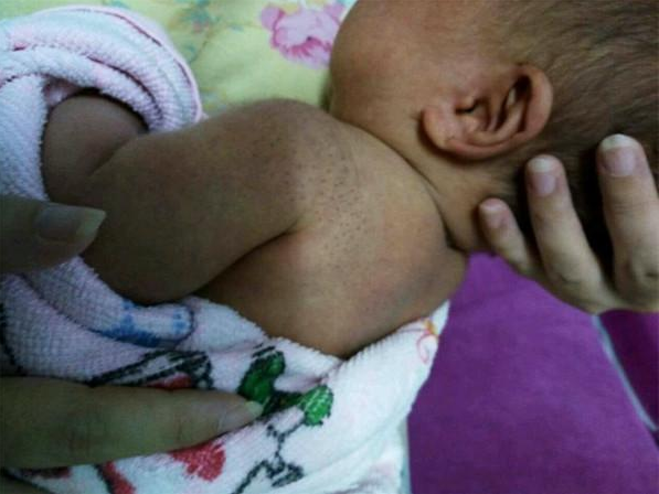 寶寶身上搓出來的黑刺是什么 寶寶身上的黑刺是胎毒嗎