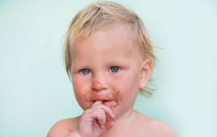 寶寶喜歡吸手指怎么辦 寶寶愛吸手指是什么原因