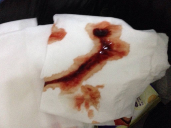 產(chǎn)后惡露多久會干凈 產(chǎn)后惡露怎么排干凈